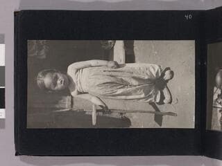 Go to image 42.