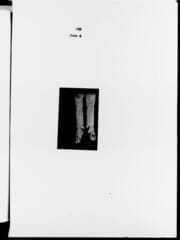 Go to image 238.